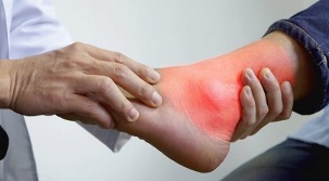 Τι μπορεί και δεν μπορεί να καταναλωθεί με ουρική αρθρίτιδα στα πόδια